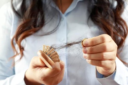 Does Iron Deficiency Cause Hair Loss?