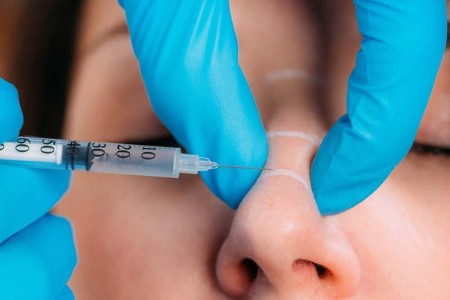 Nonsurgical Rhinoplasty