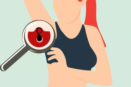 How To Get an Ingrown Hair Out at Home