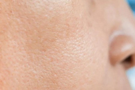 7 Ways To Minimize Pores