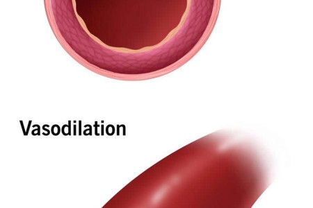 Vasodilation