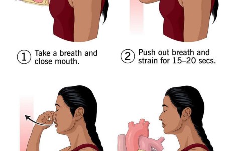 Valsalva maneuver