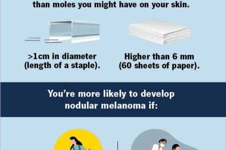 Nodular Melanoma