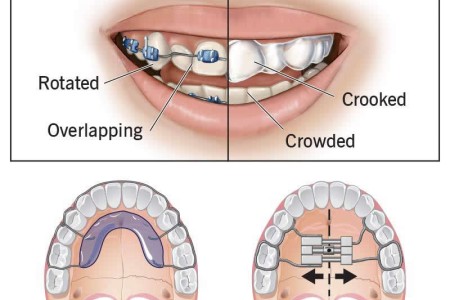 Orthodontics