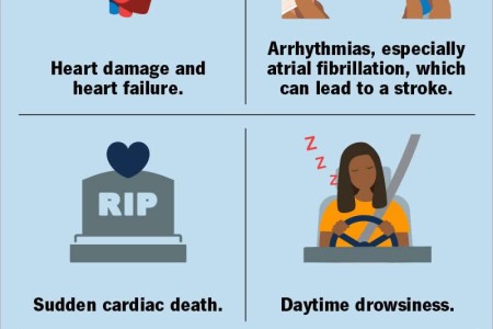 Obstructive Sleep Apnea