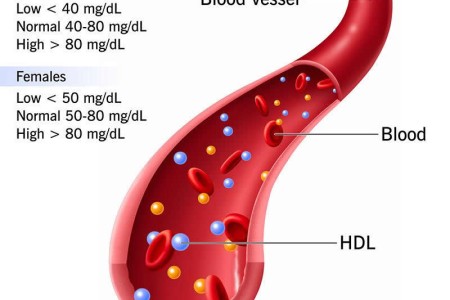 HDL Cholesterol