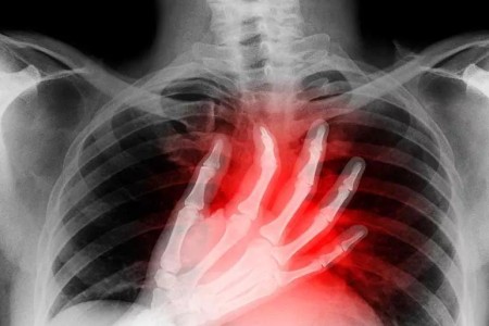 Cardiac Arrest vs. Heart Attack: What’s the Difference?