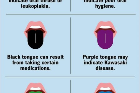 Tongue Color