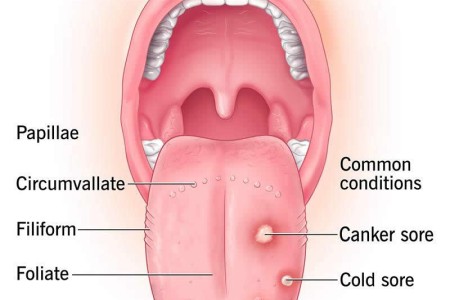 Spots on Tongue
