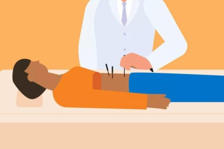 Acupuncture for Fertility: Can It Help You Get Pregnant?