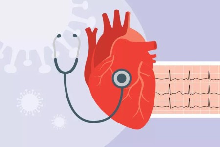 Can COVID-19 Cause Heart Palpitations?
