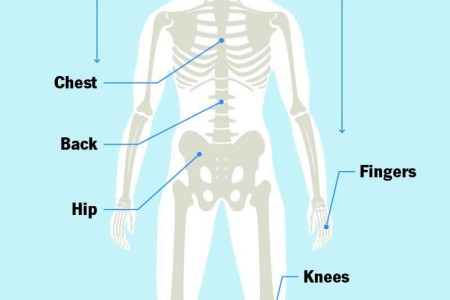 Axial Spondyloarthritis
