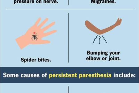 Paresthesia
