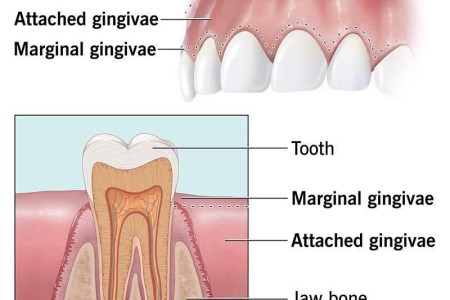 Gums