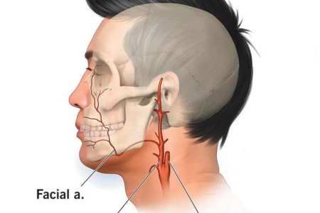 Facial Artery
