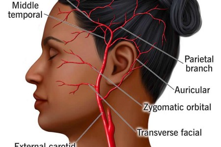 Superficial Temporal Artery
