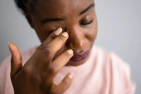 Why You Shouldn’t Pop a Stye