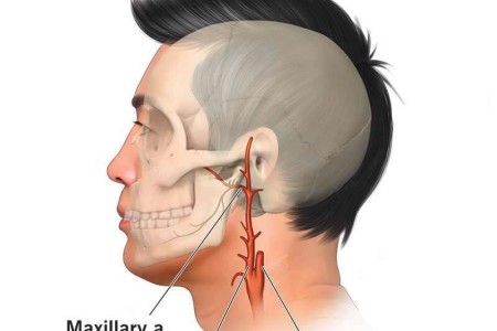 Maxillary Artery
