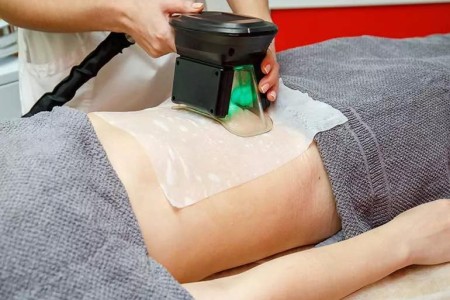 CoolSculpting’s Risks and Side Effects: What You Need To Know