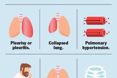 Right-Side Chest Pain