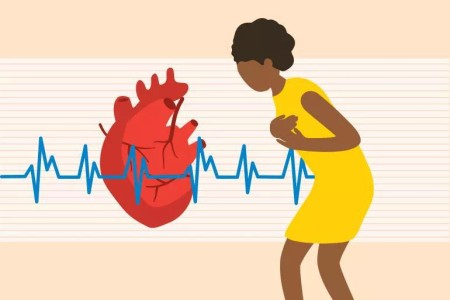 What Does a Heart Attack Feel Like?