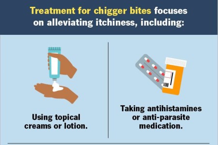 Chigger Bites