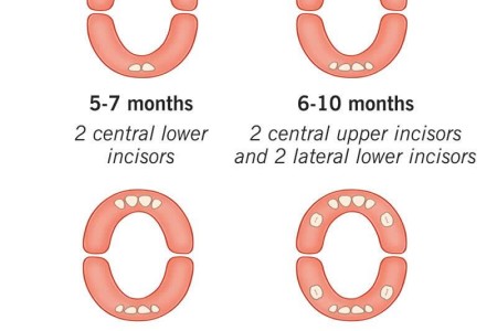 Teething/Teething Syndrome