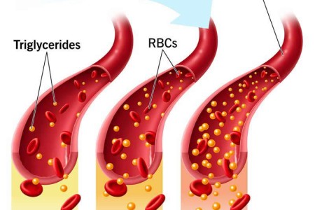 Triglycerides