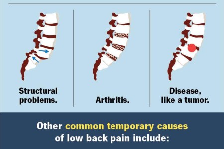 Lower Back Pain