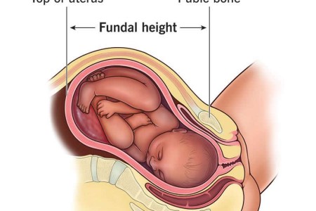 Fundal Height