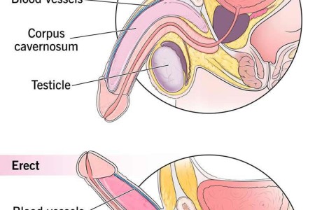 Erectile Dysfunction