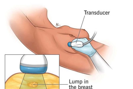 Breast Ultrasound
