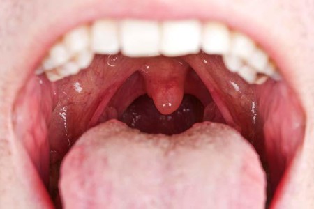 Mouth