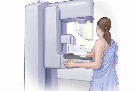 Mammogram