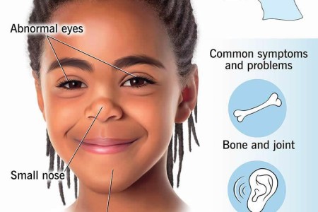 Stickler Syndrome