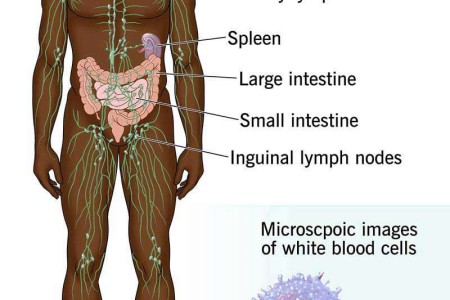 Cutaneous T-Cell Lymphoma (CTCL)