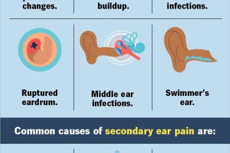 Ear Pain (Earache, Otalgia)