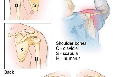 Shoulder Pain