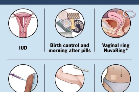 Birth Control Options