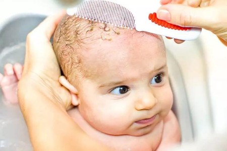 How To Get Rid of Cradle Cap in 4 Steps