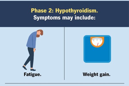 Postpartum Thyroiditis