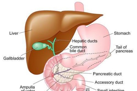Dumping Syndrome