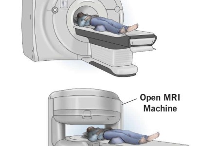 MRI (Magnetic Resonance Imaging)