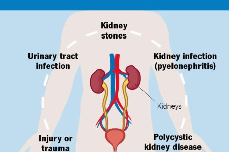 Kidney Pain
