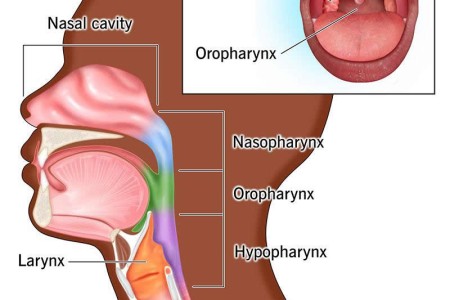 Throat Cancer