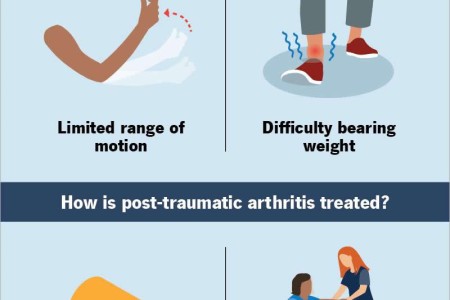 Post-Traumatic Arthritis