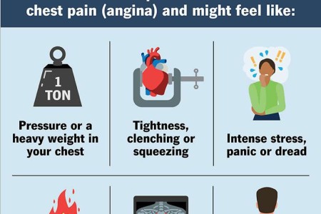 Noncardiac Chest Pain