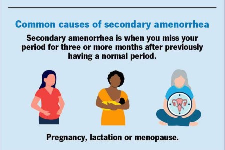 Amenorrhea