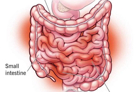 Enteritis