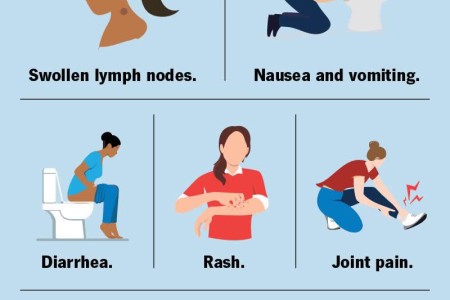 West Nile Virus